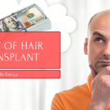 cost of hair transplant