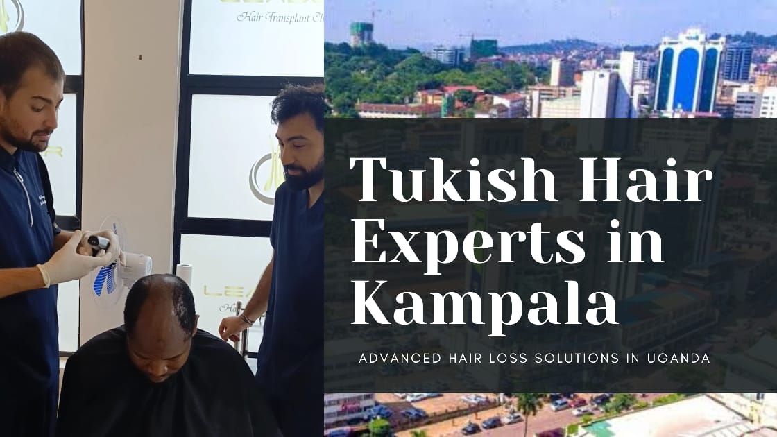 Hair Transplant in Kampala | Turkish Hair Experts Uganda