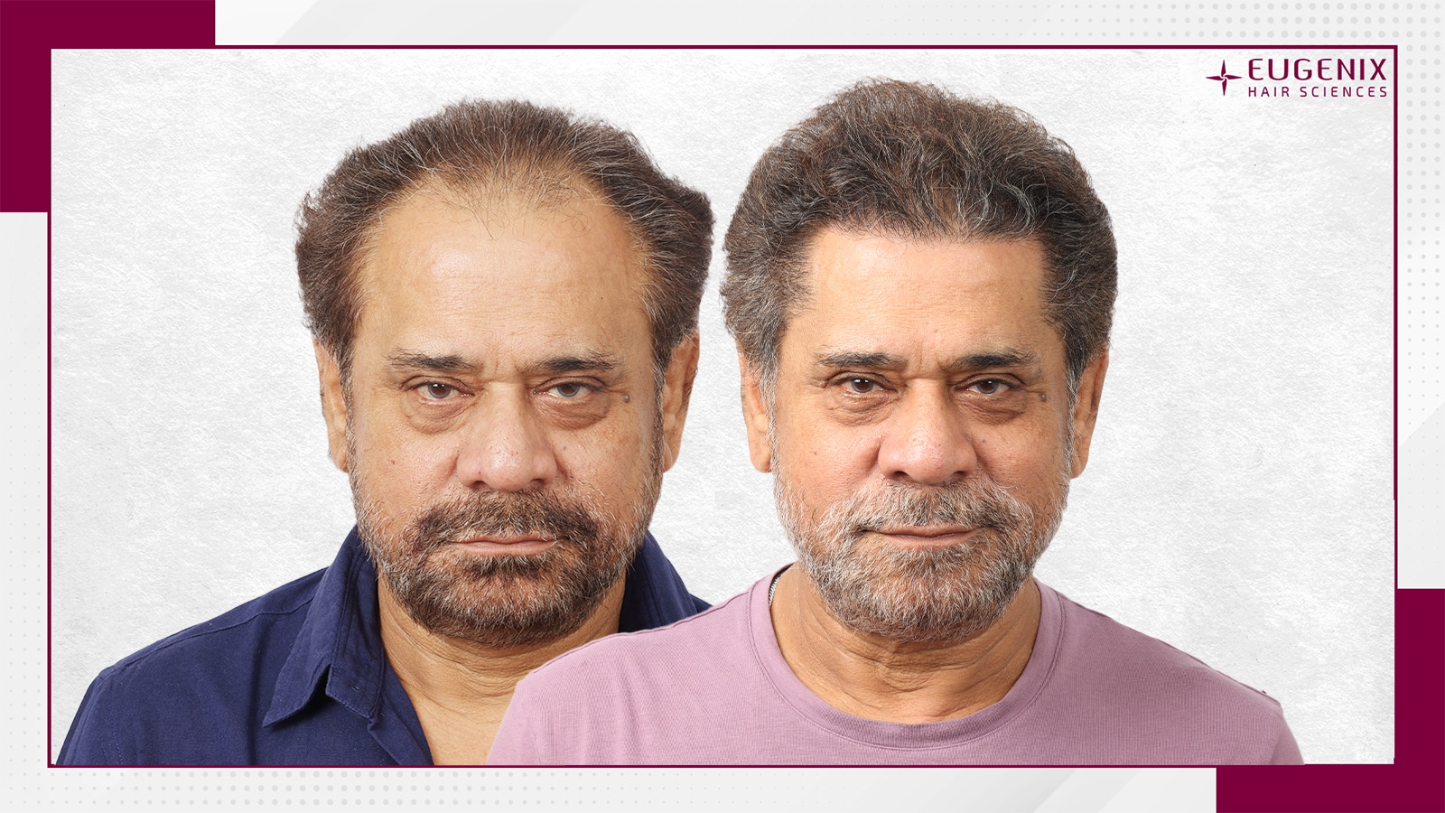 Anees-Bazmee-Front-Before-and-After-copy