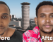 Before and After Hair Transplant