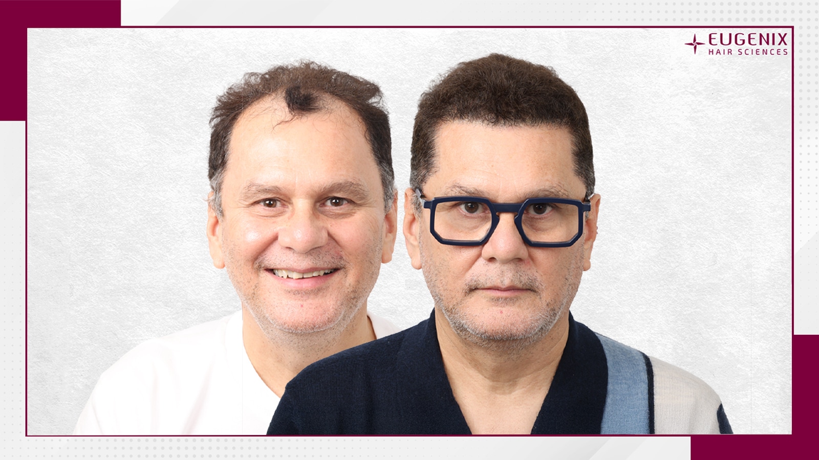 Standard-Before-After-1