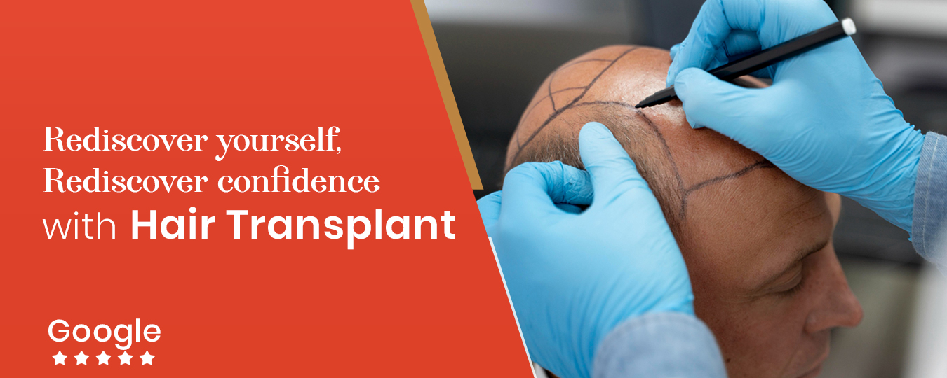 hair-transplant-banner-beautera-hair-skin-clinic