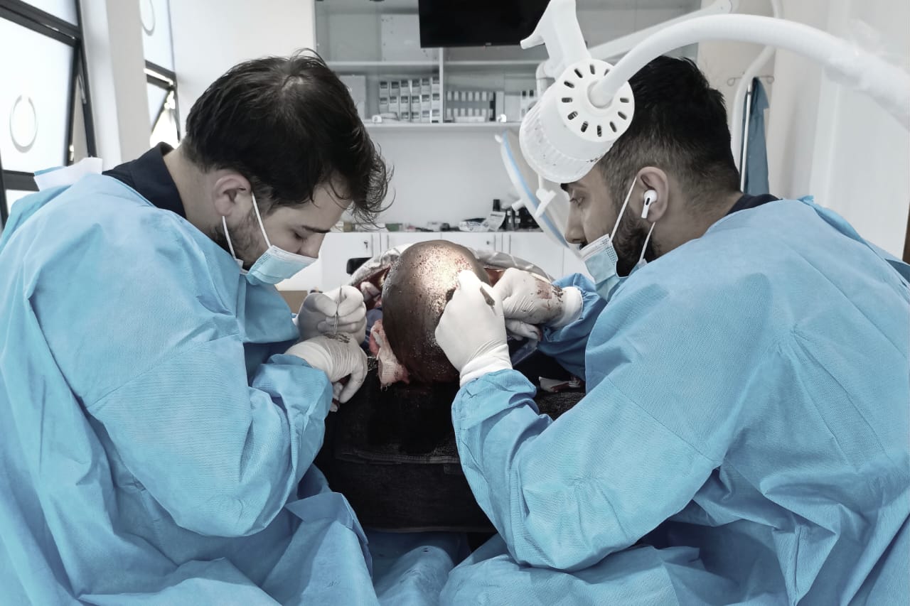 Hair Transplant Procedures in Uganda by Turkish Hair Experts