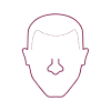 receding-hairline-transplant-icon-1